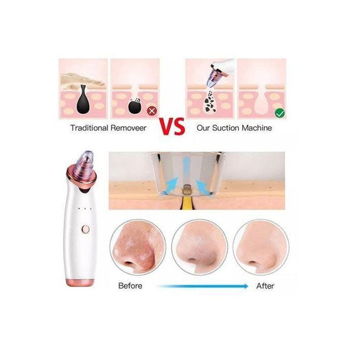 aspirateur point noir appareil simple et pratique 3 vitesses 5 Rechargeable USB