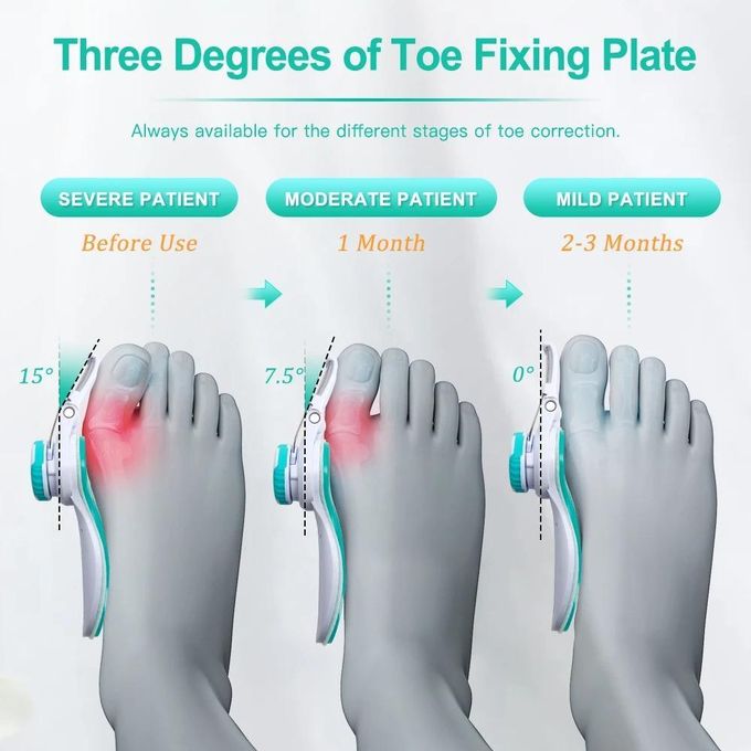 Halux Valgus Correcteur et Orthese des Gros Orteils du Pied